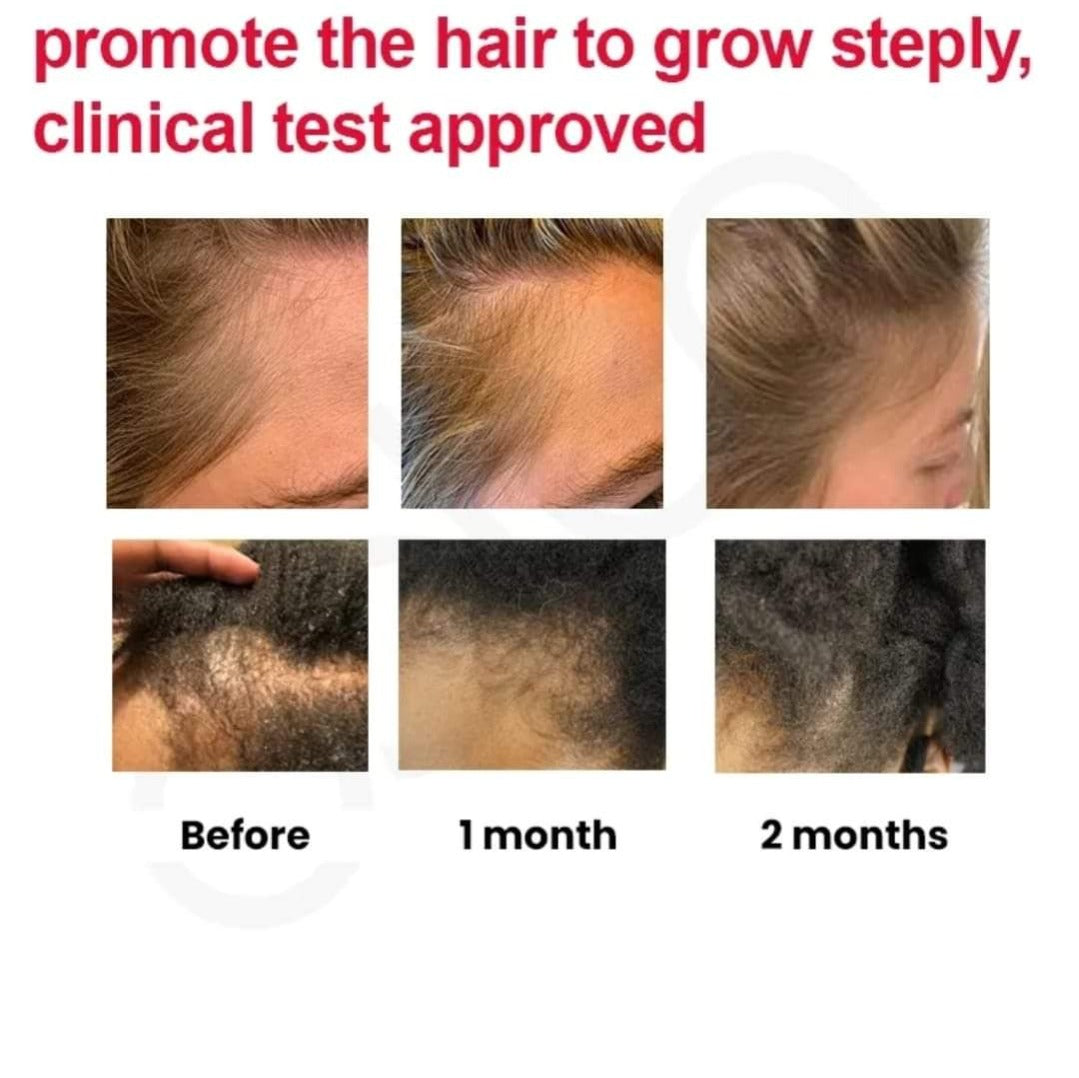 Chebe Ultimate Hair Set